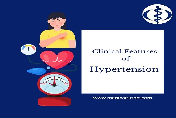 Hypertension; signs and symptoms of hypertension; clinical features of hypertension