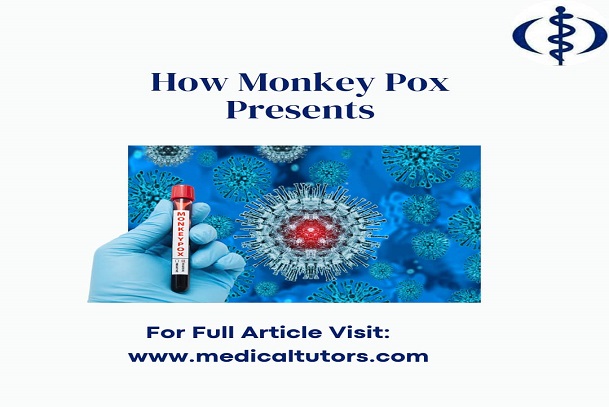 Clinical features of monkeypox; signs and symptoms of monkeypox