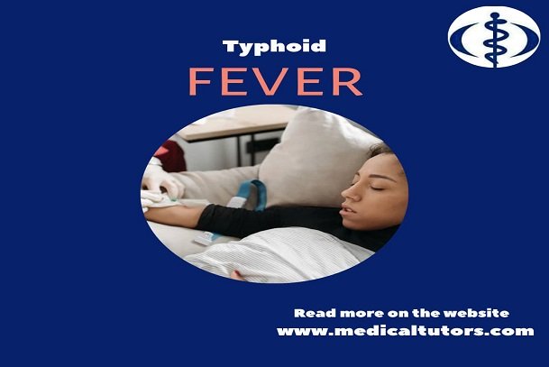 What is typhoid fever?; typhoid fever