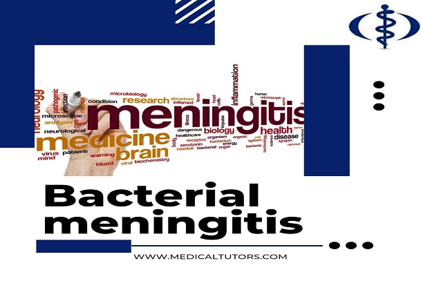 Meningitis; bacterial meningitis; epidemics of meningococcal meningitis; meningococcal meningitis