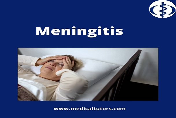 Meningitis