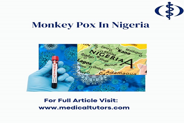 monkeypox; epidemiology of monkeypox; monkeypox in Nigeria; monkeypox pandemic in the world