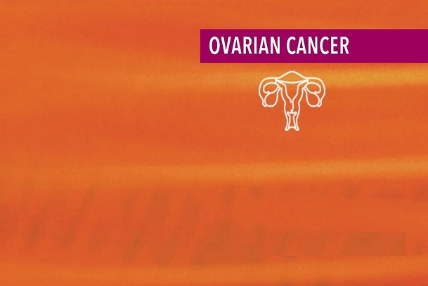 Introduction to ovarian cancer; ovarian cancer; an overview of ovarian cancer