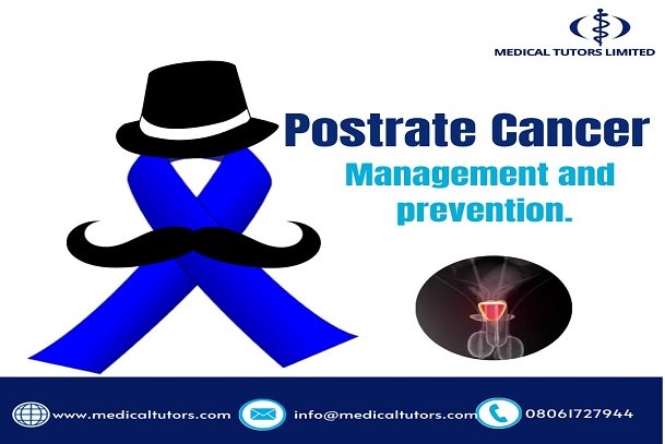 Treatment of Prostate Cancer; Can Prostate Cancer be treated? How to treat prostate cancer; Prevention of Prostate Cancer; How to prevent prostate cancer?