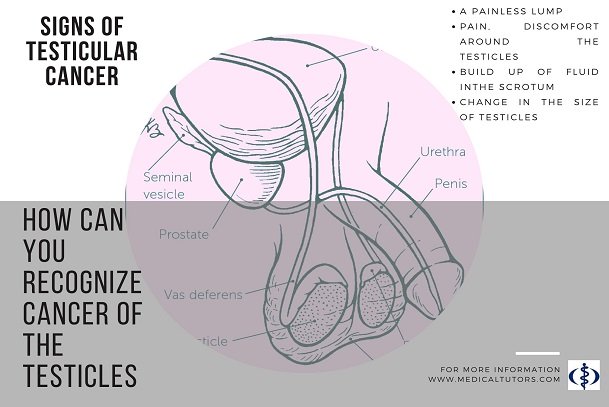 testicles; signs and symptoms of testicular cancer; recognizing testicular cancer