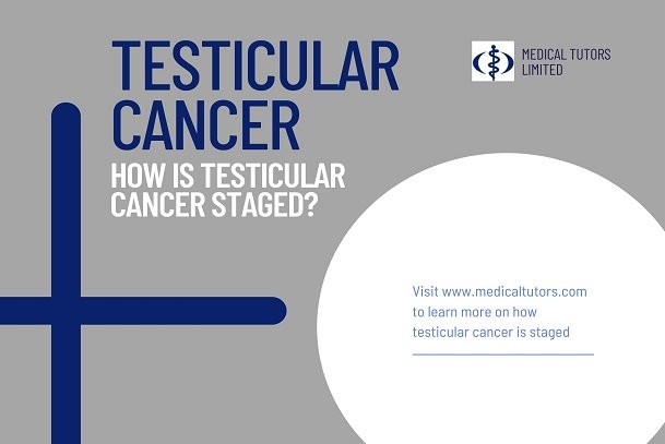 Testicular cancer stages; cancer of the testis in stages; staging testicular cancer; how is cancer of the testis staged?