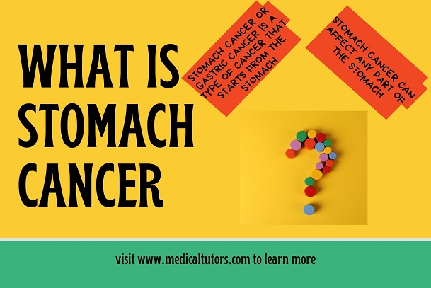Stomach Cancer; What's stomach cancer