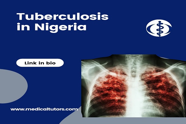 Tuberculosis; tuberculosis in Nigeria; what is tuberculosis?