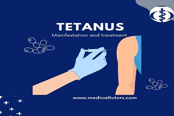 how to diagnose tetanus; signs and symptoms of tetanus; complications from tetanus; treating tetanus among individuals; how to treat tetanus; tetanus prevention; how to prevent tetanus; is tetanus preventable?; vaccine - preventable disease