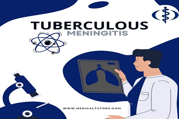 Meningitis; bacterial meningitis; epidemics of tuberculous meningitis; tuberculous meningitis