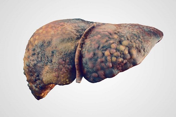 Liver cancer; cancer in men and women